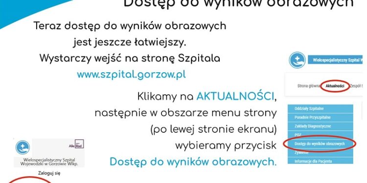 Wyniki badań radiologicznych przez internet