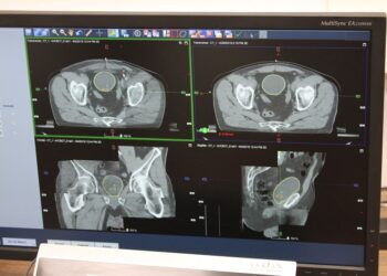 Pół tysiąca pacjentów w gorzowskim Ośrodku Radioterapii