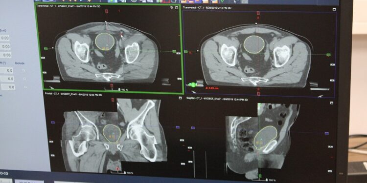 Pół tysiąca pacjentów w gorzowskim Ośrodku Radioterapii