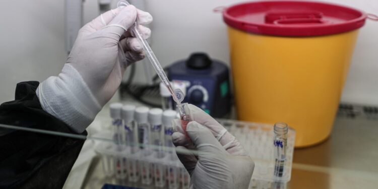 Nowy przypadek koronawirusa