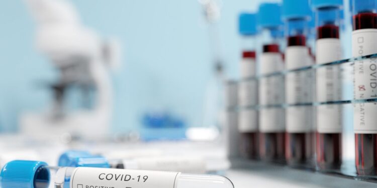 Lubuskie koronawirus