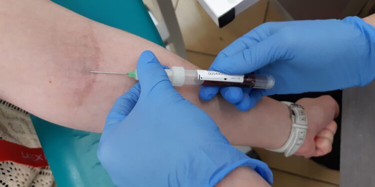 Darmowa konsultacja za osocze