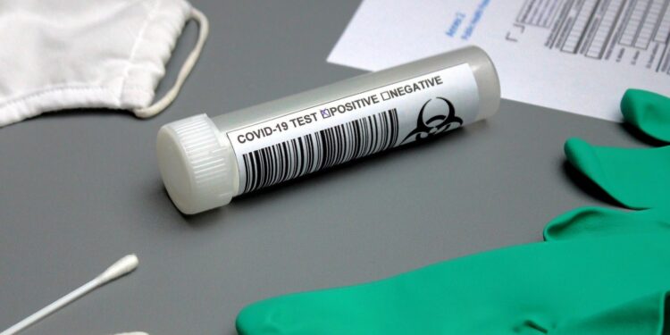 Objawy, przy których pacjent powinien być skierowany na test