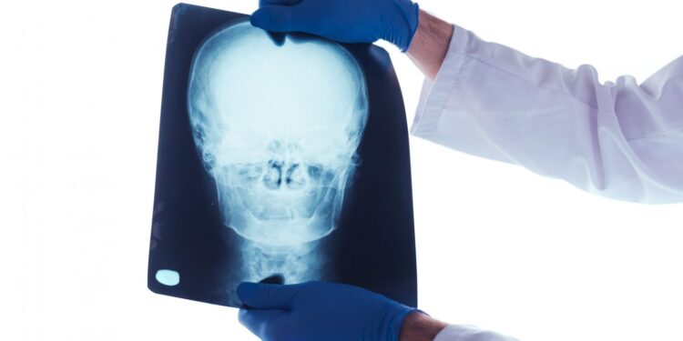 Niedziela, na zdrowie! Zadbaj o głowę i szyję