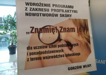 Ostrzegają uczniów przed czerniakiem