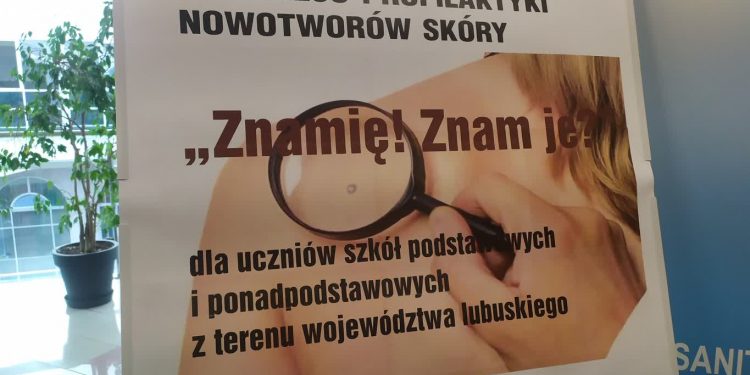 Ostrzegają uczniów przed czerniakiem