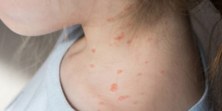 Fot: www.istockphoto.com