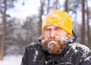 Co zrobić w razie odmrożeń
