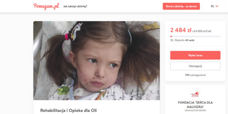 Pomoc dla 4-letniej Oli
