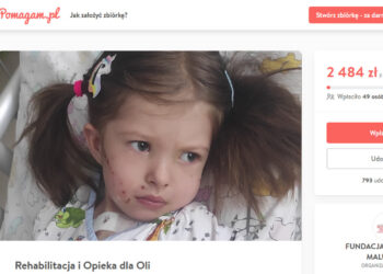 4-letnia Ola potrzebuje pomocy. Liczy się każda złotówka